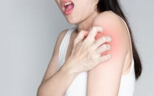 POLA HIDUP SEHAT YANG HARUS DITERAPKAN PENDERITA EKSIM penderita eksim